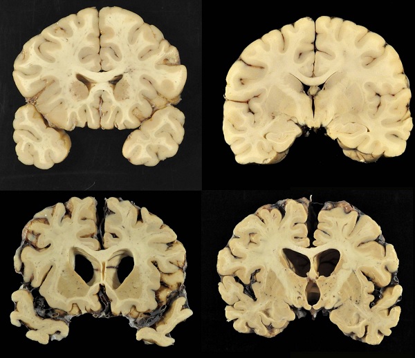 Cerebro NFL