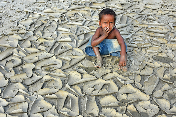 Chinmoy Biswas Dryness