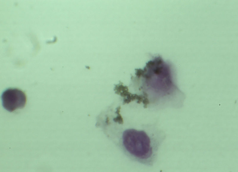 parasitounal
